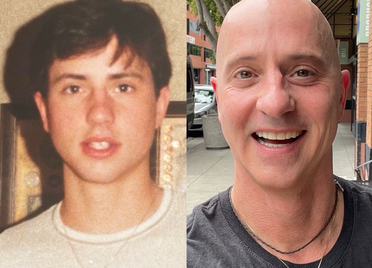 Brian Boitano's Health Journey: Debunking Myths About His Baldness